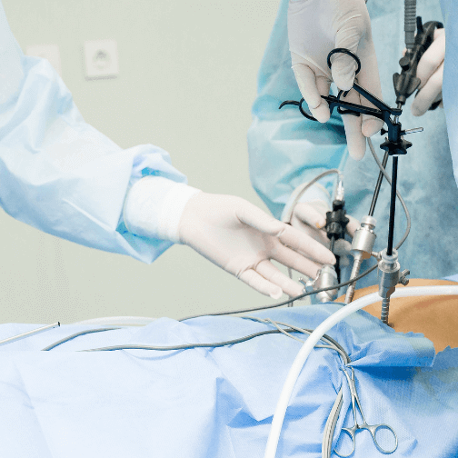A importância de uma boa recuperação pós-laparoscopia!
